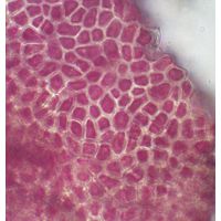 Hildenbrandia rivularis