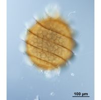 Nitella mucronata