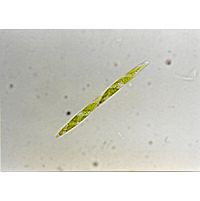 Closteriospira lemanensis