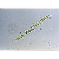Closteriospira lemanensis