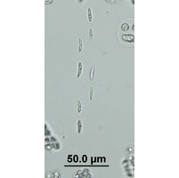 Elakatothrix genevensis