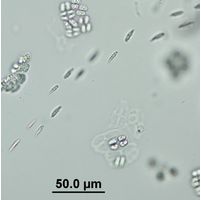 Elakatothrix genevensis