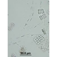 Elakatothrix genevensis