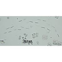 Elakatothrix genevensis