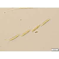 Elakatothrix genevensis
