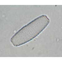 Actinotaenium adelochondrum