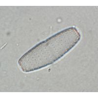 Actinotaenium adelochondrum