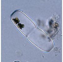 Actinotaenium crassiusculum