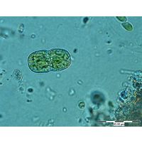 Actinotaenium cucurbita