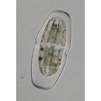 Actinotaenium cucurbitinum