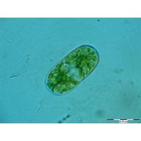 Actinotaenium diplosporum