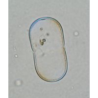 Actinotaenium diplosporum
