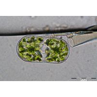 Actinotaenium diplosporum