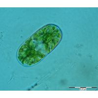 Actinotaenium diplosporum