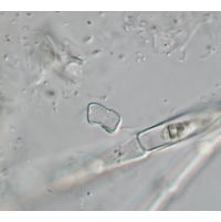Actinotaenium geniculatum