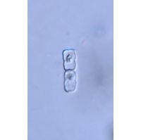 Actinotaenium geniculatum