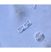 Actinotaenium geniculatum