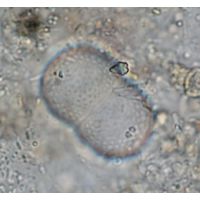Actinotaenium globosum