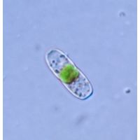 Actinotaenium inconspicuum