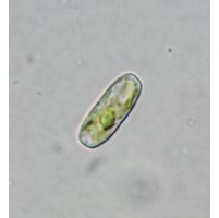 Actinotaenium inconspicuum