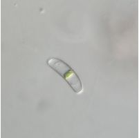 Actinotaenium inconspicuum