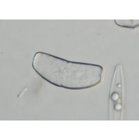 Actinotaenium infractum