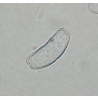 Actinotaenium infractum
