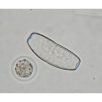 Actinotaenium infractum