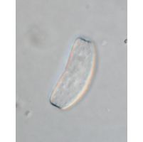 Actinotaenium infractum