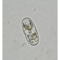 Actinotaenium kriegeri