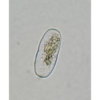 Actinotaenium kriegeri