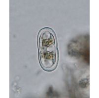 Actinotaenium kriegeri