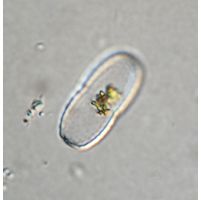 Actinotaenium kriegeri