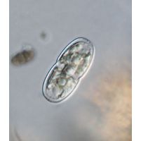 Actinotaenium kriegeri