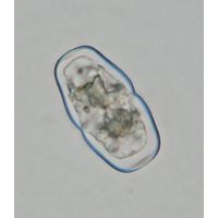 Actinotaenium obcuneatum