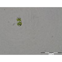 Actinotaenium perminutum