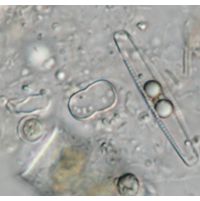 Actinotaenium perminutum