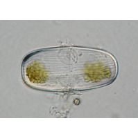 Actinotaenium silvae-nigrae