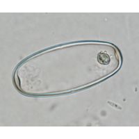 Actinotaenium