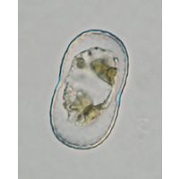 Actinotaenium trachypolum