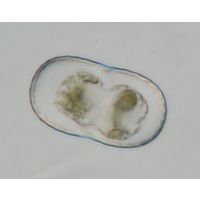 Actinotaenium trachypolum