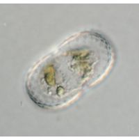 Actinotaenium trachypolum