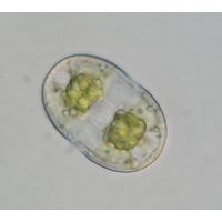 Actinotaenium wollei