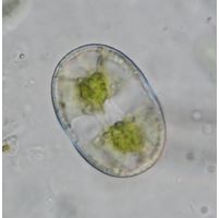 Actinotaenium wollei