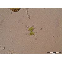 Arthrodesmus octocornis