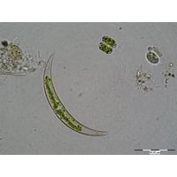 Closterium venus