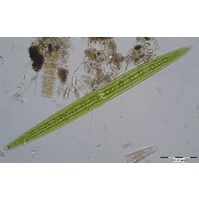 Closterium acerosum