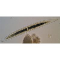 Closterium acerosum