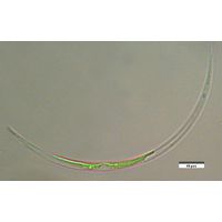 Closterium acutum