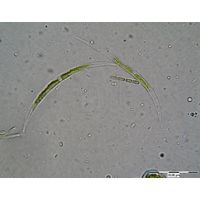 Closterium acutum